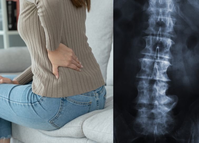 chiropractic treatment for disc herniation