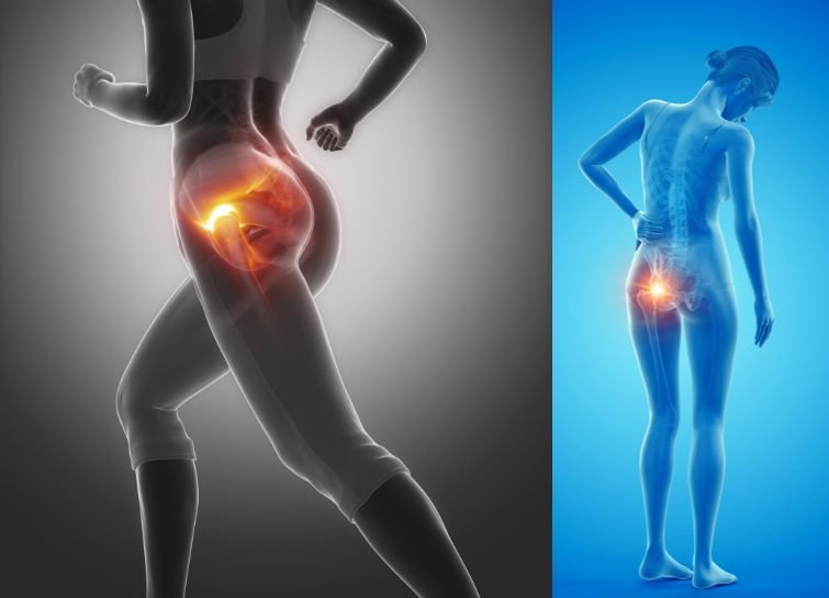 hip pain in india